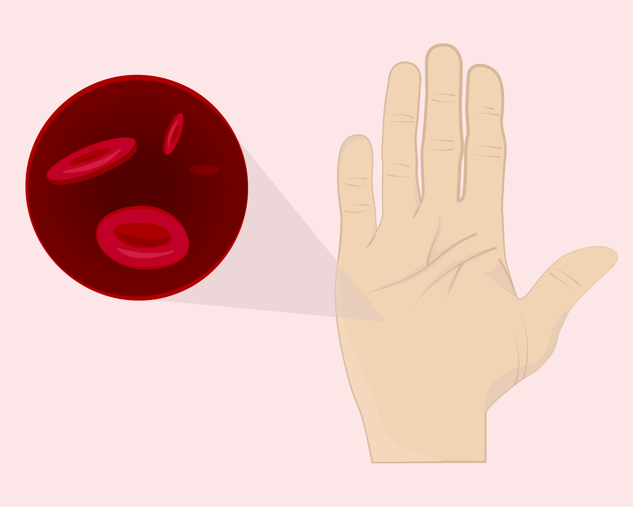 Anemia: A Common Side Effect of Heavy Periods