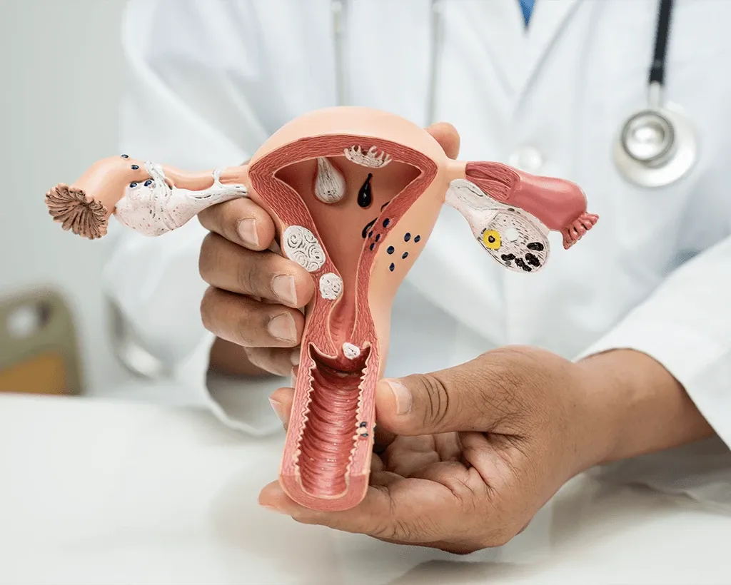 Menstrual Problems & Disorders