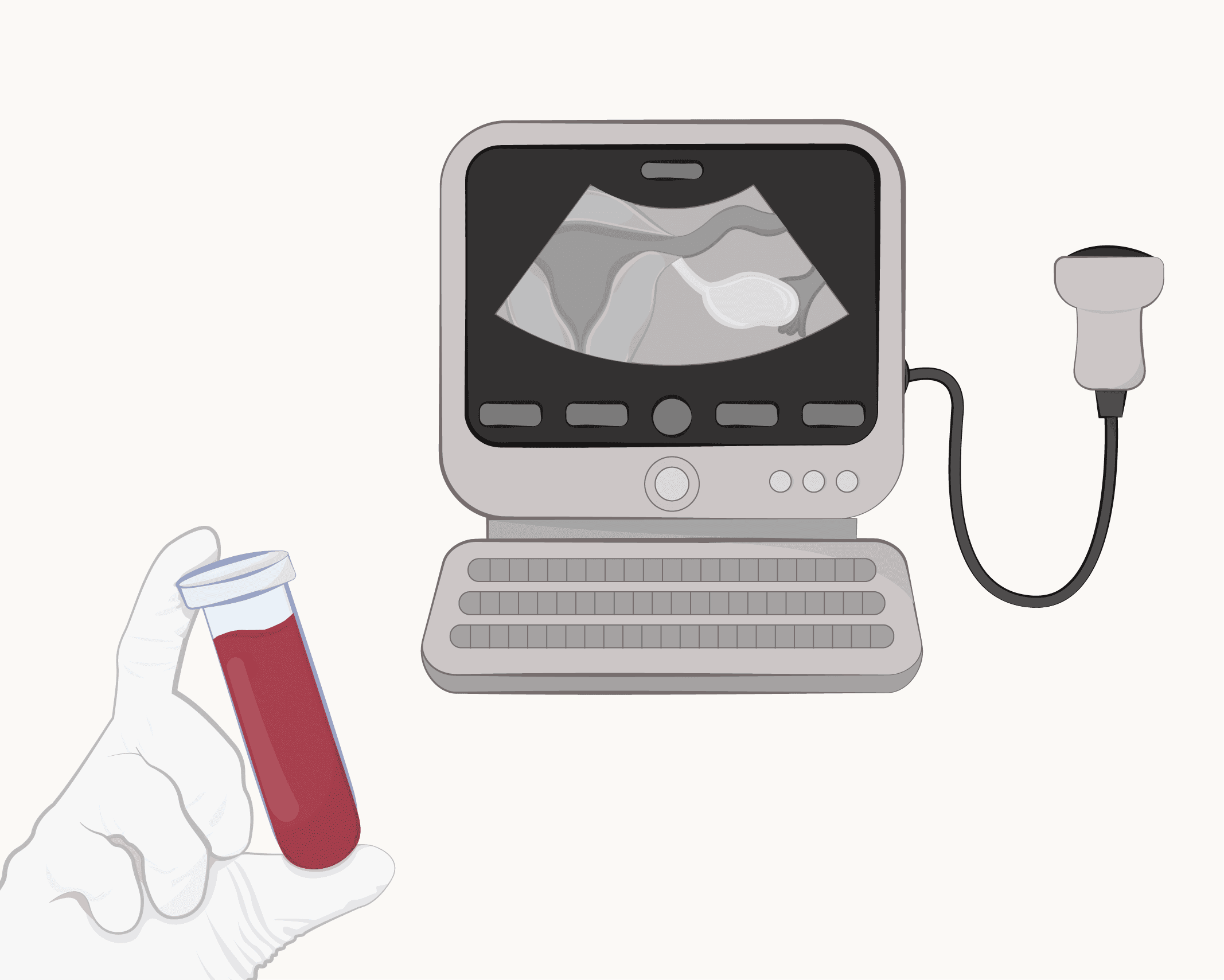 Irregular Periods: The Essential Tests Needed.