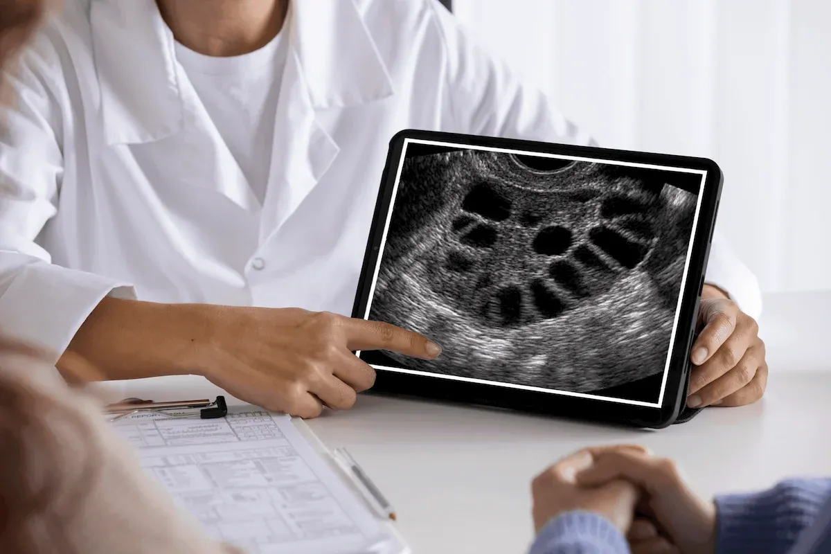 The PCOS Program